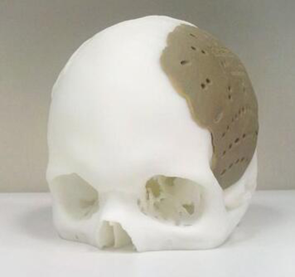 医疗模型3d打印服务案例